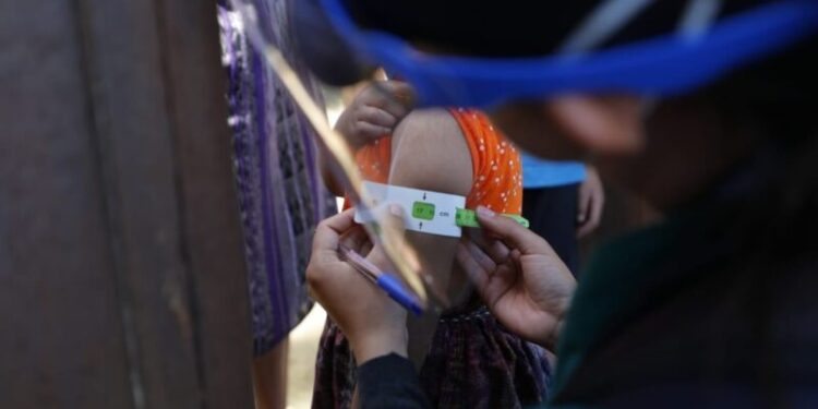 Instituciones de gobierno informan de acciones para combatir la desnutrición aguda severa