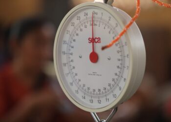 Desnutrición aguda en Guatemala: prevalencia, causas y tratamiento