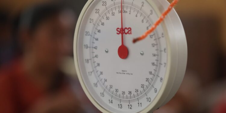 Desnutrición aguda en Guatemala: prevalencia, causas y tratamiento