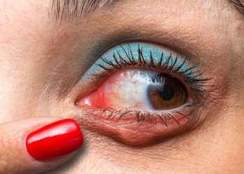 Pequeñas medidas ayudan a cuidar la salud ante las condiciones del aire