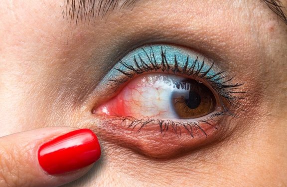 Pequeñas medidas ayudan a cuidar la salud ante las condiciones del aire