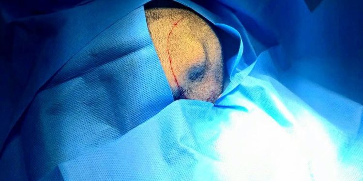 Atención médica especializada: Hospital de San Benito atiende a paciente con tumor cerebral
